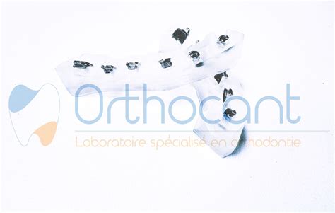 orthocant|OrthoCant (SRL) .